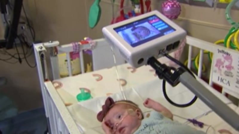 Special cameras help NICU families stay close, even when separated