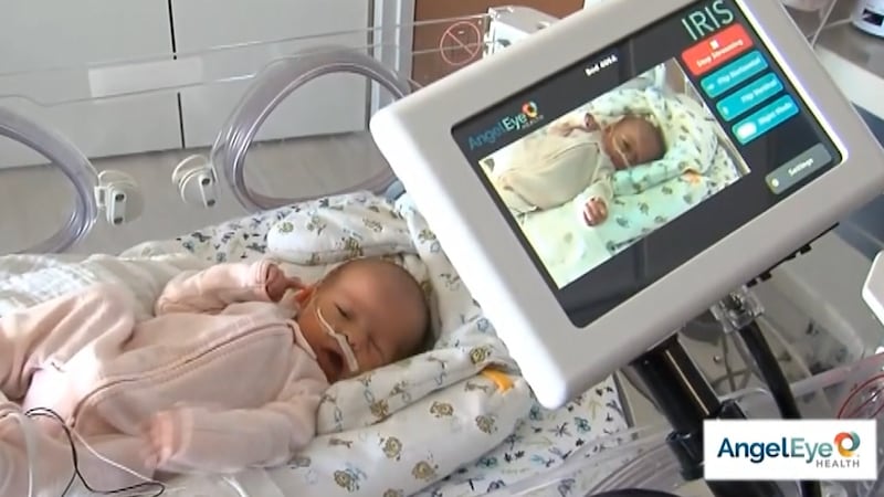 AngelEye camera of NICU baby.